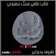 قالب طلقی 1076